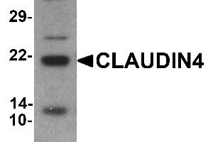 Western blot analysis of CLAUDIN4 in human colon tissue lysate with CLAUDIN4 antibody at 1 µg/mL (Claudin 4 抗体  (C-Term))