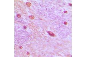 Immunohistochemical analysis of SRSF3 staining in human brain formalin fixed paraffin embedded tissue section. (SRSF3 抗体  (C-Term))