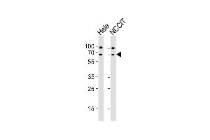All lanes : Anti-GNL3 Antibody (N-term) at 1:2000 dilution Lane 1: Hela whole cell lysates Lane 2: NCCIT whole cell lysates Lysates/proteins at 20 μg per lane. (Nucleostemin 抗体  (N-Term))