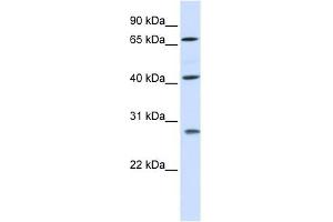 RDM1 antibody used at 1 ug/ml to detect target protein. (RDM1 抗体  (Middle Region))