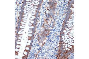 Immunohistochemistry of paraffin-embedded human appendix using Creatine kinase B type (CKB) Rabbit mAb (ABIN7266515) at dilution of 1:100 (40x lens). (CKB 抗体)