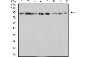Western blot analysis using KDM1A mouse mAb against SK-Br-3 (1), K562 (2), SW480 (3), Jurkat (4), Hela (5), COS7 (6), T47D (7), and HCT116 (8) cell lysate. (LSD1 抗体  (AA 55-263))