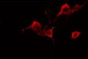 ABIN6277989 staining A549 cells by IF/ICC. (Amyloid beta (A4) Precursor Protein-Binding, Family B, Member 1 Interacting Protein (APBB1IP) (Internal Region) 抗体)