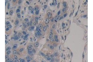Immunohistochemistry (IHC) image for anti-R-Spondin 3 (RSPO3) (AA 22-272) antibody (ABIN7430150)