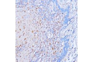 Immunohistochemistry of paraffin-embedded human esophageal using NME6 antibody (ABIN7268942) at dilution of 1:100 (40x lens). (NME6 抗体  (AA 9-194))