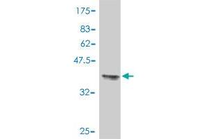 Western Blot detection against Immunogen (37. (TUBB2A 抗体  (AA 1-100))