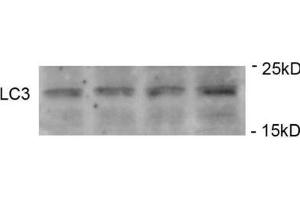Western Blotting (WB) image for anti-Microtubule-Associated Protein 1 Light Chain 3 gamma (MAP1LC3C) (pSer12) antibody (ABIN2970987) (LC3C 抗体  (pSer12))