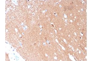 Formalin-fixed, paraffin-embedded human Brain stained with Tubulin beta 3 Mouse Monoclonal Antibody (TUBB3/3731). (TUBB3 抗体  (AA 437-450))