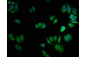 Immunofluorescence staining of HepG2 cells with ABIN7146892 at 1:66, counter-stained with DAPI. (CSNK2A2 抗体  (AA 8-350))