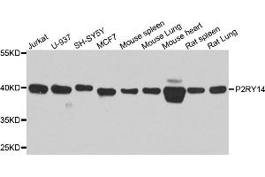 Western blot analysis of extract of various cells, using P2RY14 antibody. (P2RY14 抗体)
