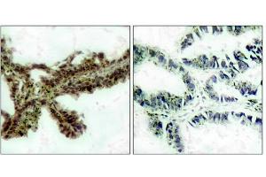 Immunohistochemistry (IHC) image for anti-V-Akt Murine Thymoma Viral Oncogene Homolog 1 (AKT1) (pThr308) antibody (ABIN7138831)