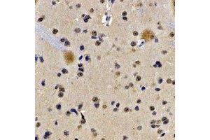Immunohistochemical analysis of Lamin B Receptor staining in rat brain formalin fixed paraffin embedded tissue section. (Lamin B Receptor 抗体)