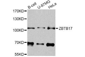 Western blot analysis of extracts of various cell lines, using ZBTB17 Antibody (ABIN5974597) at 1/1000 dilution. (ZBTB17 抗体)