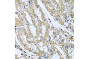 Immunohistochemistry of paraffin-embedded human stomach using STX7 antibody (ABIN6128800, ABIN6148669, ABIN6148670 and ABIN6224079) at dilution of 1:100 (40x lens). (Syntaxin 7 抗体  (AA 1-170))