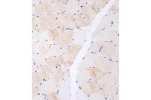 Immunohistochemical analysis of (ABIN655236 and ABIN2844840) on paraffin-embedded human skeletal muscle tissue was performed on the Leica®BOND RXm.