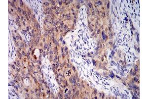 Immunohistochemistry (IHC) image for anti-Complement Component 1, Q Subcomponent, A Chain (C1QA) (AA 23-167) antibody (ABIN5542308)