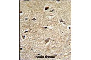 Immunohistochemistry (Paraffin-embedded Sections) (IHC (p)) image for anti-BCL2-Associated Athanogene (BAG1) (AA 258-285), (C-Term) antibody (ABIN389451)