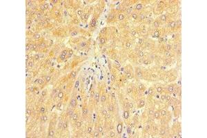 Immunohistochemistry of paraffin-embedded human liver tissue using ABIN7147720 at dilution of 1:100 (CHD4 抗体  (AA 1-219))