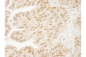 Immunohistochemistry (IHC) image for anti-Ubiquitin Specific Peptidase 15 (USP15) (C-Term) antibody (ABIN7448852) (USP15 抗体  (C-Term))