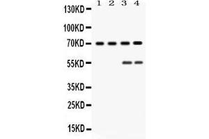 Western blot analysis of YAP1 expression in rat testis extract ( Lane 1), mouse ovary extract ( Lane 2), HELA whole cell lysates ( Lane 3) and MCF-7 whole cell lysates ( Lane 4). (YAP1 抗体  (N-Term))