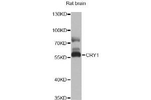 Western blot analysis of extracts of rat brain, using CRY1 antibody. (CRY1 抗体)