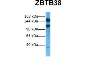 Host:  Rabbit  Target Name:  ZBTB38  Sample Tissue:  Human Hela  Antibody Dilution:  1. (ZBTB38 抗体  (N-Term))