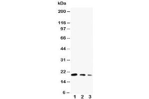 Western blot testing of CDC42 antibody and Lane 1:  ecombinant human protein 10ng (CDC42 抗体  (Middle Region))