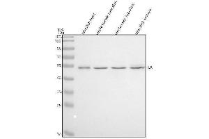 Western blot analysis of ILK using anti-ILK antibody (AZQ6PHD6).