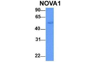 Host:  Rabbit  Target Name:  NOVA1  Sample Type:  Human Adult Placenta  Antibody Dilution:  1. (NOVA1 抗体  (C-Term))