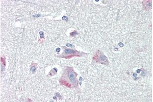 Immunohistochemistry (IHC) image for anti-Corticotropin Releasing Hormone Receptor 1 (CRHR1) (AA 250-263) antibody (ABIN190893)