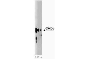 Western blot analysis of Synaptotagmin on rat brain lysate. (Synaptotagmin 抗体  (AA 72-223))