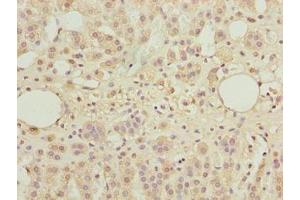 Immunohistochemistry of paraffin-embedded human adrenal gland tissue using ABIN7171598 at dilution of 1:100 (TBC1D14 抗体  (AA 136-435))