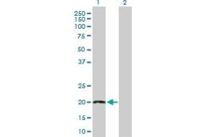 Western Blot analysis of TWIST2 expression in transfected 293T cell line by TWIST2 MaxPab polyclonal antibody. (TWIST2 抗体  (AA 1-160))