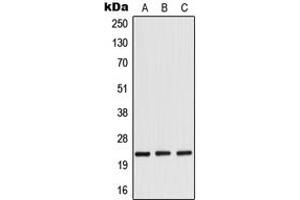 Western blot analysis of RANBP1 expression in HeLa (A), mouse brain (B), rat brain (C) whole cell lysates. (RANBP1 抗体  (Center))
