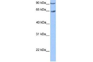 Transfected 293T; WB Suggested Anti-ZNF449 Antibody Titration: 0. (ZNF449 抗体  (C-Term))