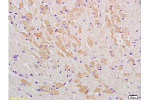 Formalin-fixed and paraffin embedded mouse heart labeled with Rabbit Anti-GLUT12 Polyclonal Antibody, Unconjugated (ABIN741765) at 1:200, followed by conjugation to the secondary antibody and DAB staining (GLUT12 抗体  (AA 251-350))