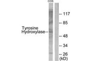 Western blot analysis of extracts from COS7, using Tyrosine Hydroxylase (Ab-31) Antibody. (Tyrosine Hydroxylase 抗体  (AA 1-50))