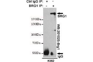 Immunoprecipitation (IP) image for anti-SWI/SNF Related, Matrix Associated, Actin Dependent Regulator of Chromatin, Subfamily A, Member 4 (SMARCA4) antibody (ABIN6241306)