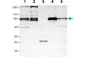 Western Blot analysis of Lane 1: RT-4, Lane 2: U-251MG sp, Lane 3: human plasma (IgG/HSA depleted), Lane 4: human liver and Lane 5: human tonsil lysates with ACSS2 polyclonal antibody . (ACSS2 抗体)