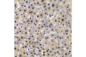 Immunohistochemistry (Paraffin-embedded Sections) (IHC (p)) image for anti-Karyopherin (Importin) alpha 4 (KPNA4) (AA 1-240) antibody (ABIN3015855)