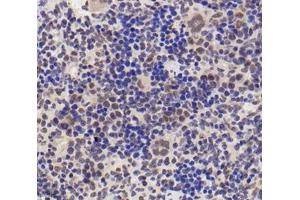 Immunohistochemistry (Paraffin-embedded Sections) (IHC (p)) image for anti-Small Nuclear Ribonucleoprotein D2 Polypeptide 16.5kDa (SNRPD2) antibody (ABIN7075634)