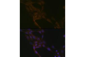 Immunofluorescence (IF) image for anti-SMAD Specific E3 Ubiquitin Protein Ligase 2 (SMURF2) antibody (ABIN1680578)