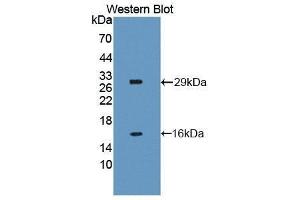 Western Blotting (WB) image for anti-NLR Family, Apoptosis Inhibitory Protein (NAIP) (AA 500-759) antibody (ABIN1859963) (NAIP 抗体  (AA 500-759))