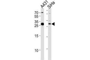 Western Blotting (WB) image for anti-Hydroxysteroid (17-Beta) Dehydrogenase 12 (HSD17B12) antibody (ABIN3004142) (HSD17B12 抗体)
