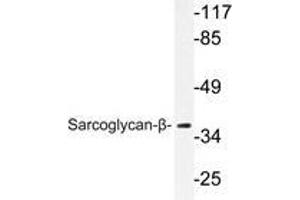 Western blot analysis of Sarcoglycan-β antibody in extracts from A549 cells. (SGCB 抗体)