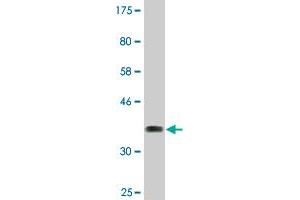 Western Blot detection against Immunogen (37. (TRIM16 抗体  (AA 165-273))
