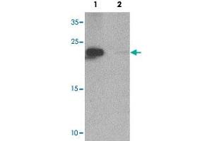 Western blot analysis of NIH/3T3 cell tissue lysate with ZFYVE21 polyclonal antibody  at 1 ug/mL in (1) the absence and (2) the presence of blocking peptide. (ZFYVE21 抗体  (N-Term))