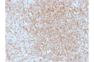 Immunohistochemistry (IHC) image for anti-Tumor Necrosis Factor Receptor Superfamily, Member 9 (TNFRSF9) (AA 19-188) antibody (ABIN6939788)