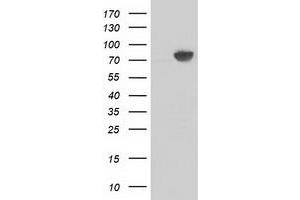 Western Blotting (WB) image for anti-Catenin (Cadherin-Associated Protein), beta 1, 88kDa (CTNNB1) antibody (ABIN1496897) (CTNNB1 抗体)