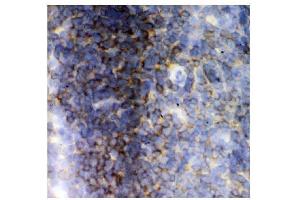 IHC analysis of Lck using anti-Lck antibody (ABIN3043870).
